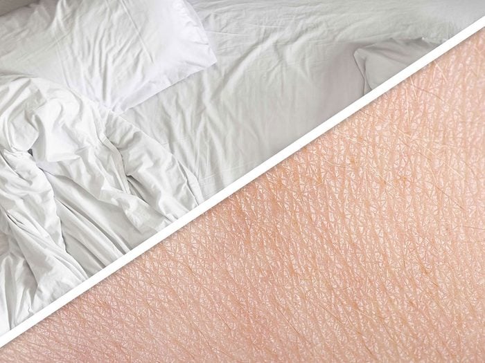Lésiner sur le sommeil fait partie des habitudes quotidiennes qui détruisent la peau.