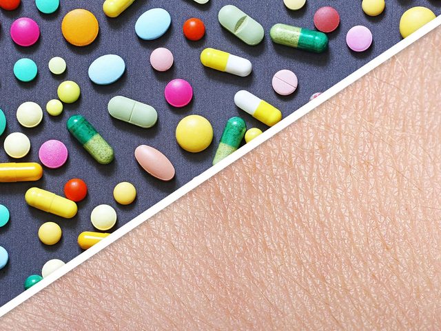 Prendre des antibiotiques fait partie des habitudes quotidiennes qui dtruisent la peau.