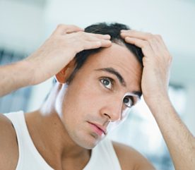 1. La perte de cheveux est un phénomène génétique transmis par le père. 