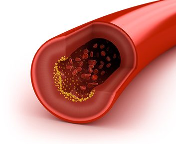 5 façons de maintenir un niveau santé de cholestérol