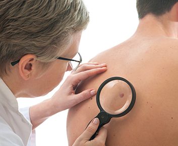 Cancer de la peau: nouveau moyen rapide de le détecter