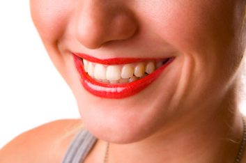De quel pourcentage la fluoration réduit-elle les caries dentaires? 
