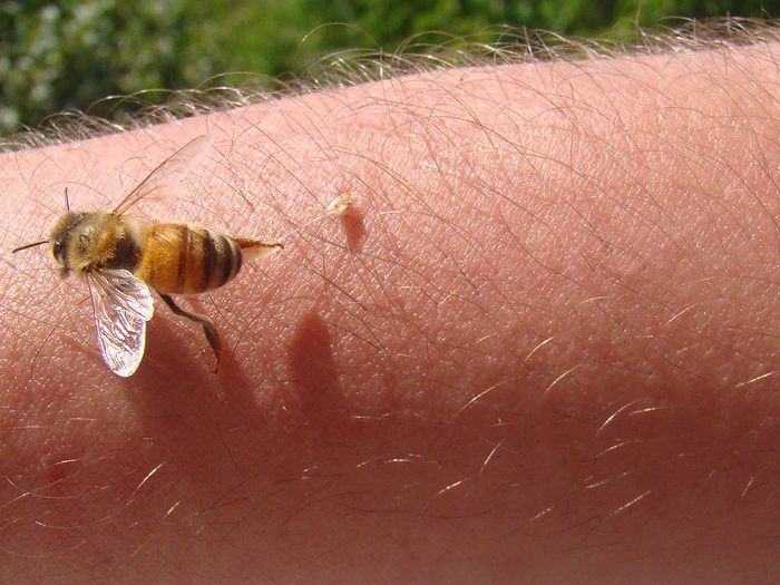 Une abeille pique le bras d'un humain.