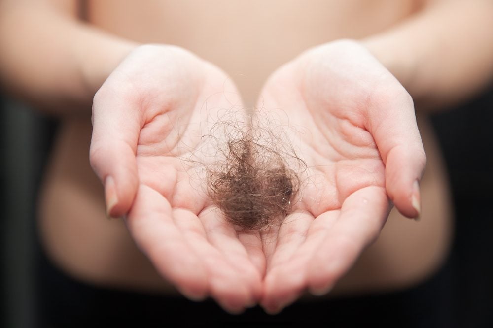 Problèmes de cheveux: les meilleurs remèdes naturels et suppléments. 