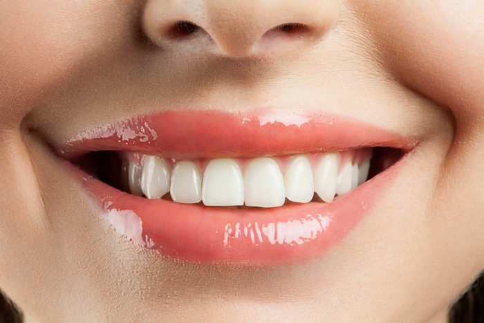Dents tachées: le secret d'un sourire parfait