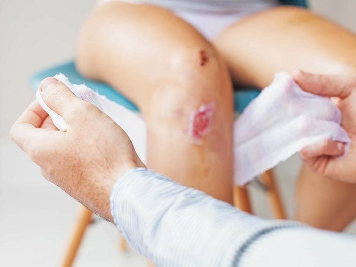 9 signes d'infection à ne jamais ignorer après à une blessure