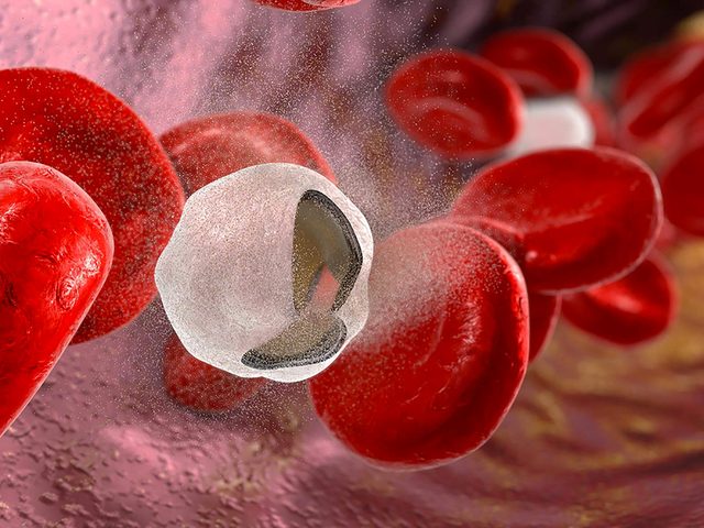 Souffle au cur: image de globules rouges et blanches.
