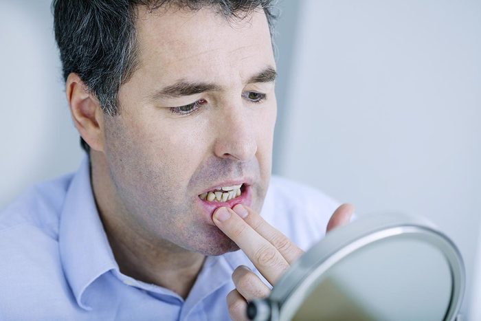 Le de mal de dents peut être du à des gencives rétractées.