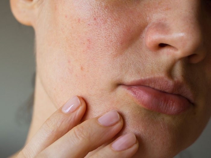 10 maladies dangereuses révélées par votre visage | Sélection.ca
