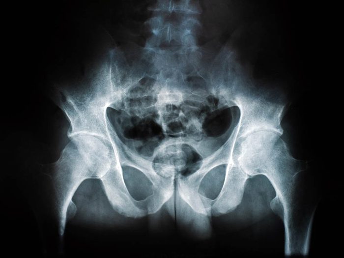 Objets volés les plus étranges: des radiographies.