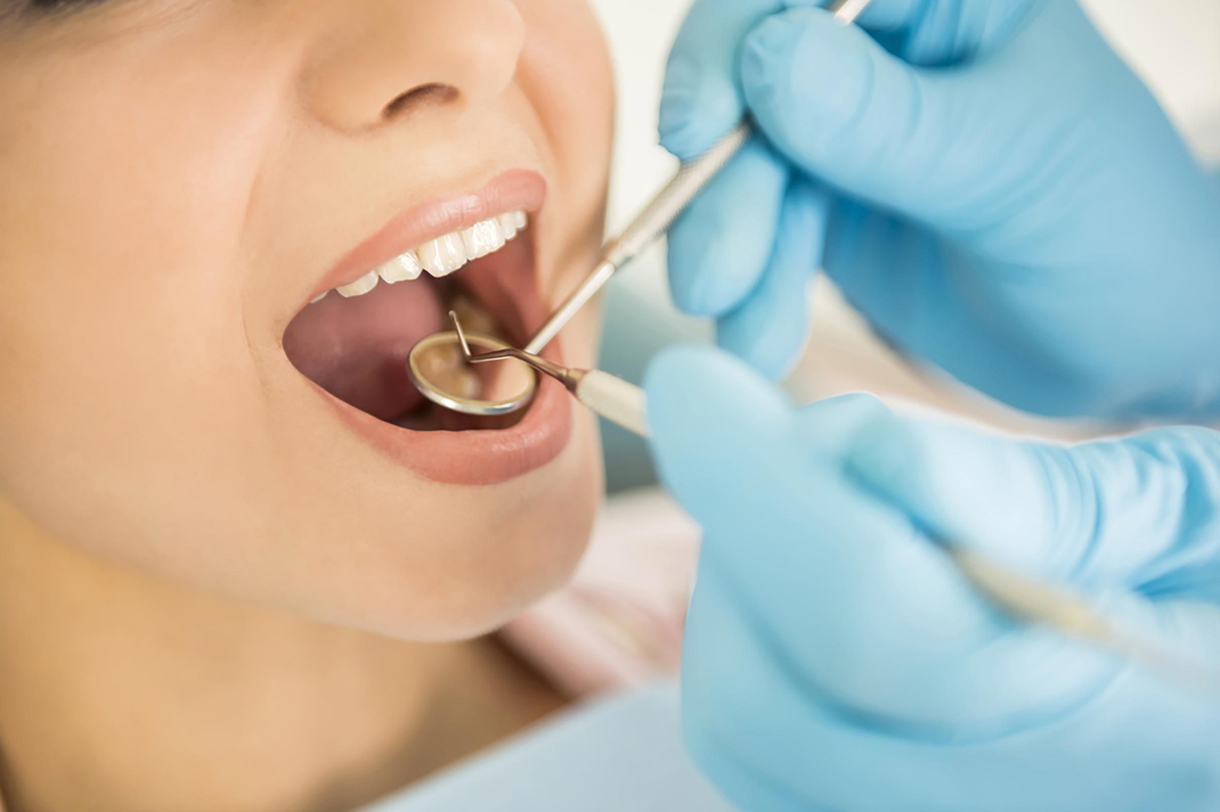 Conseil sant : consulter un dentiste tous les six mois