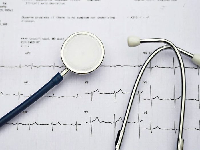 Des problèmes cardiaques peuvent être la cause de votre douleur entre les omoplates.