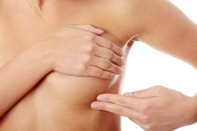 Signes de cancer mconnus : l'apparition dingalits et de dcoloration sur la peau des seins.