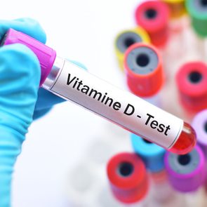 Seul un test de sang peut diagnostiquer une carence en vitamine D.