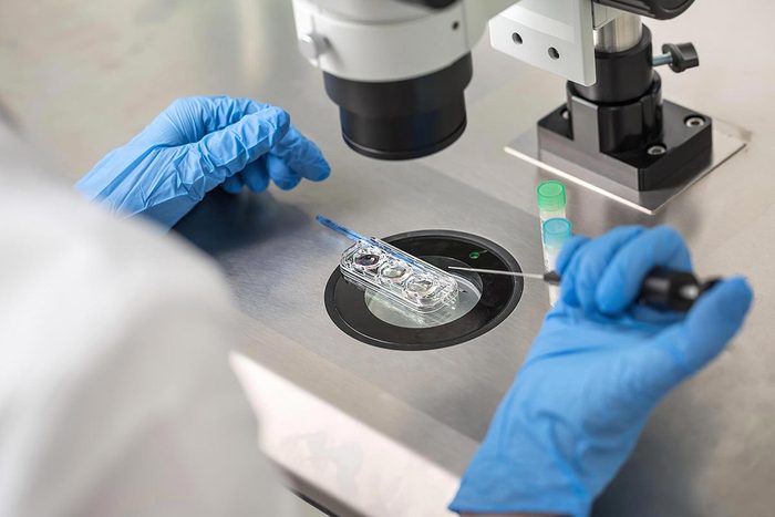 Cancer col utérus : un nouveau test de dépistage pourrait détrôner les tests Pap et VPH.