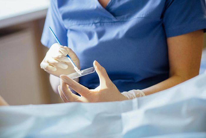 Cancer col utérus : le test PAP réduit les risque de mortalité.