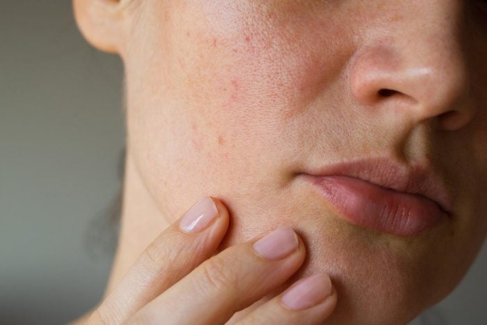 8 symptômes de maladie révélés par votre peau - Sélection.ca