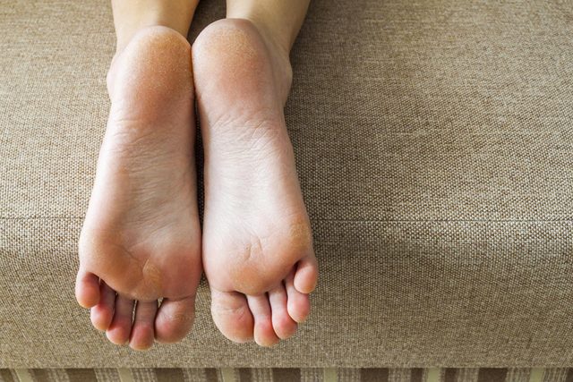 Symptme d'anmie : vos mains et vos pieds sont froids