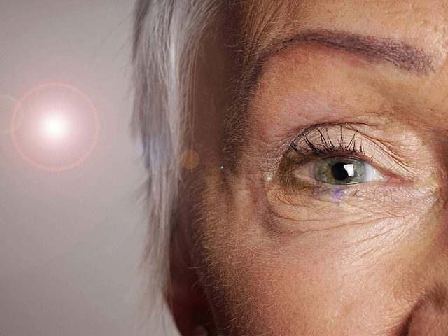 La diplopie (vision double) fait partie des symptmes de la cataracte.
