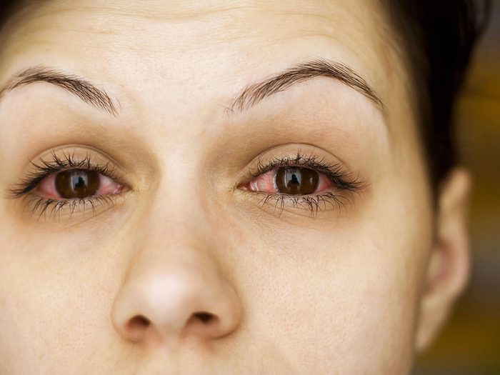 Les massothérapeutes peuvent savoir si vos allergies sont en progression.
