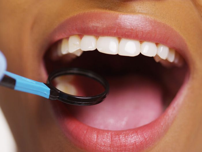 L'orthodontiste évitera de vous dire que votre traitement pourrait durer plus longtemps que prévu.