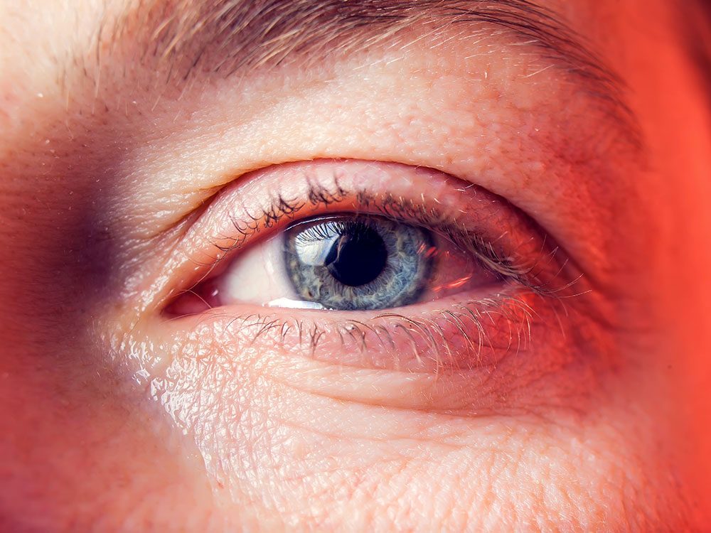 Santé des yeux: des yeux humides ou larmoyants peuvent être un signe d’allergie.