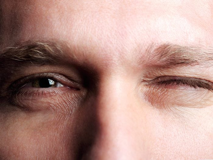 Symptôme de commotion cérébrale: une dilatation irrégulière des pupilles.