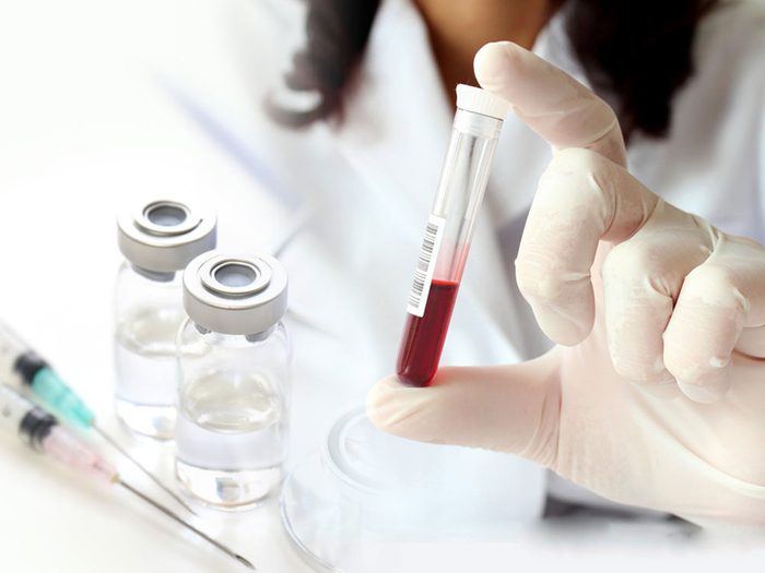 Les tests cutanés et sanguins pour les allergies ne sont pas définitifs.