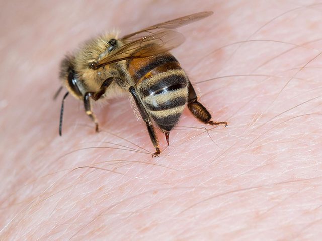 Les piqres d'abeilles font partie des dangers de l't  surveiller.