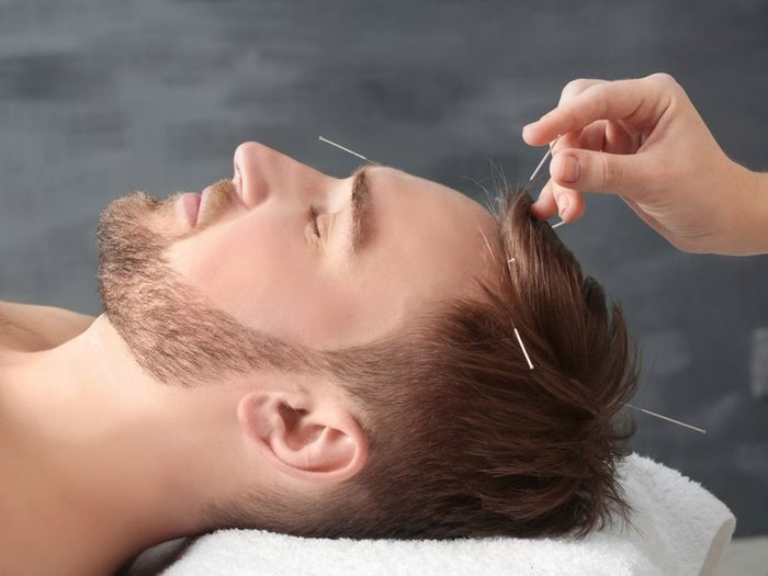 Utiliser l’acupression ou l’acupuncture pour soulager les maux de tête.