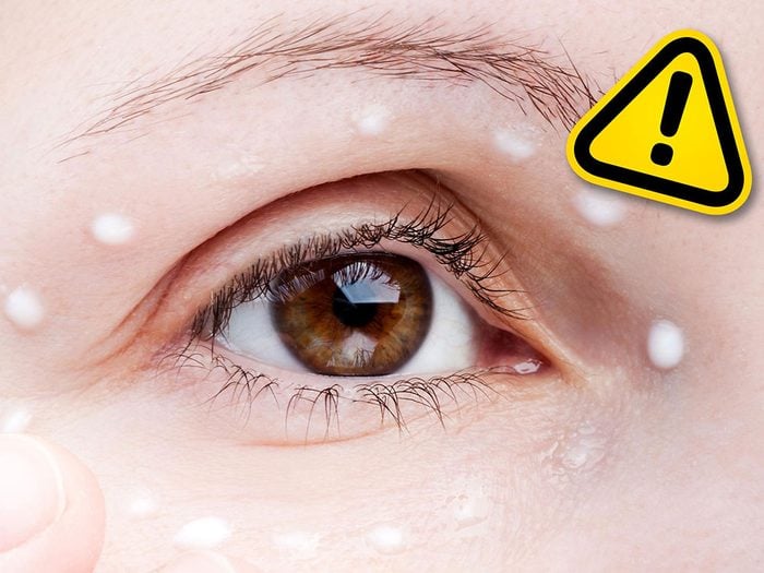 Appliquer de la crème pour les hémorroïdes sur les yeux gonflés est l'une des tendances beauté qu'il vaut mieux oublier.