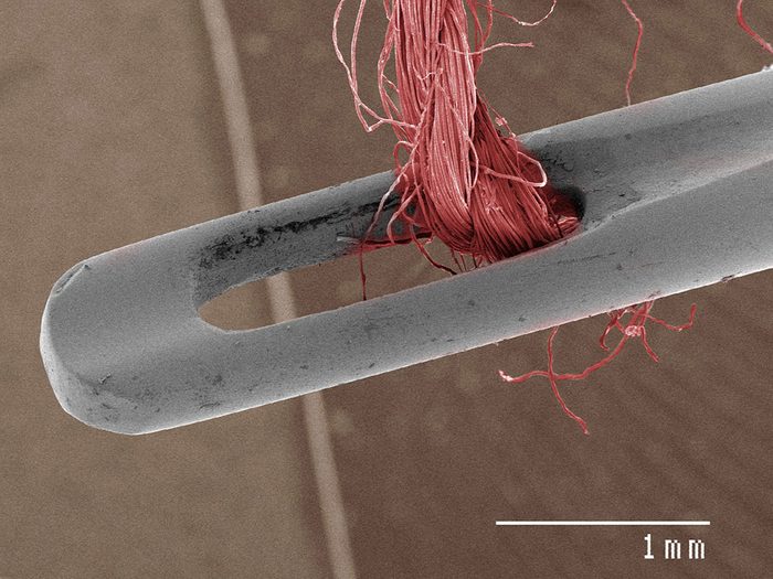 Une aiguille et du fil en image au microscope.