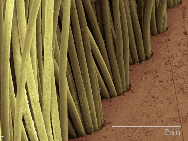 Des poils de brosse  dents en image au microscope.