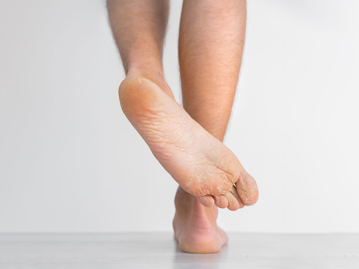 10 signes subtils sur les pieds révélateurs de maladies