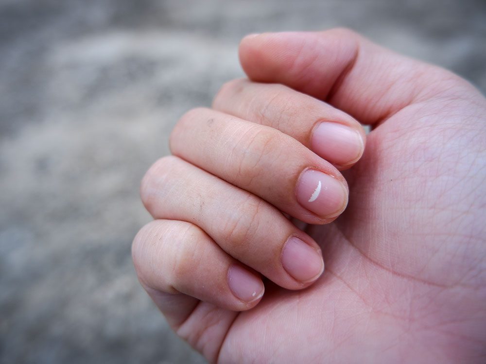 Ce que signifie une tache blanche sur un ongle | Sélection.ca