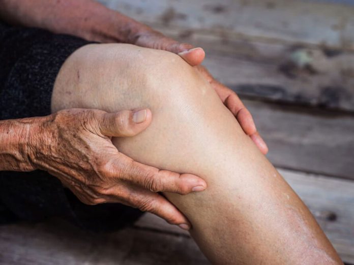 Des douleurs musculaires peuvent être signe d’arthrite.