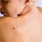 Soins de la peau: 37 des pires affirmations entendues par des dermatologues