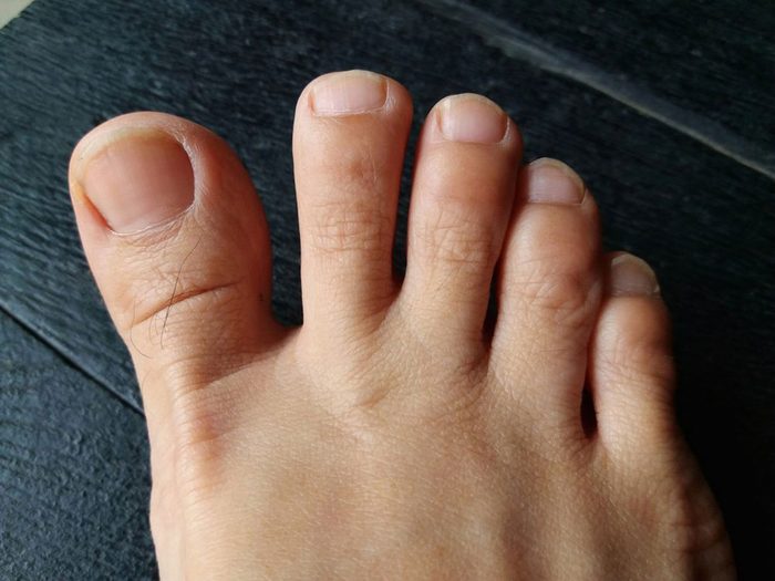 La mauvaise odeur des pieds fait partie des odeurs corporelles qu'il ne faut pas ignorer.