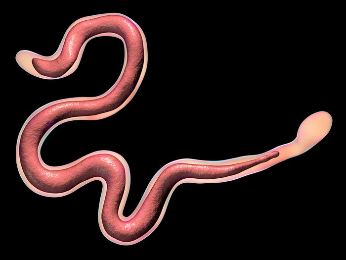 Brugia,malayi,,a,roundworm,nematode,,one,of,the,causative,agents