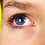 Yeux irrités: Les 8 signes silencieux du syndrome de l’œil sec