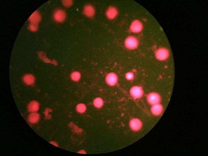 Infection Transmise Sexuellement Its Chlamydia