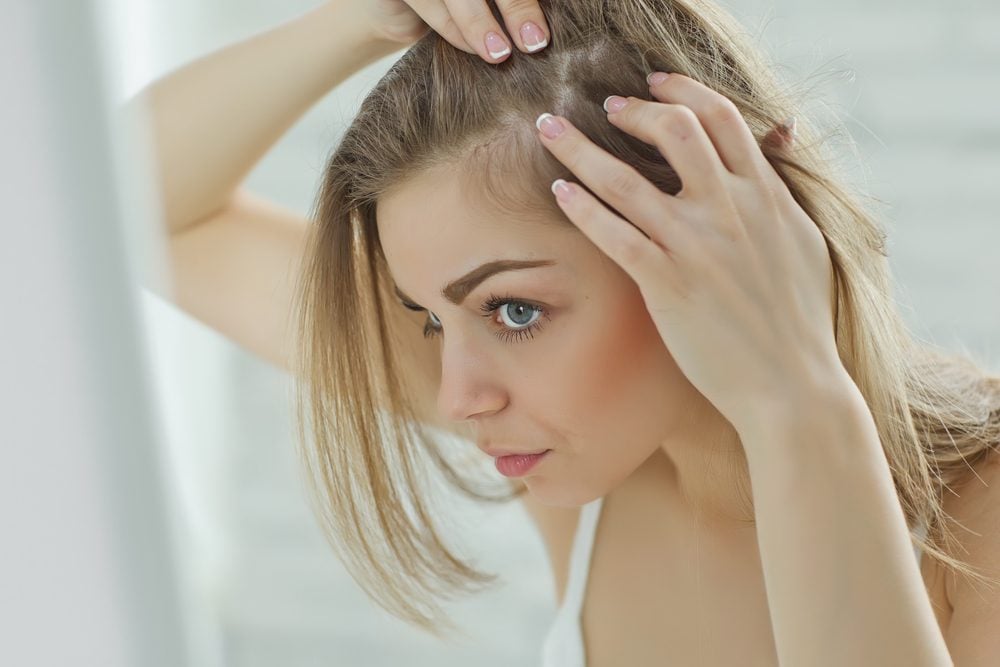 Femmes et perte de cheveux: les 10 meilleurs remèdes et traitements