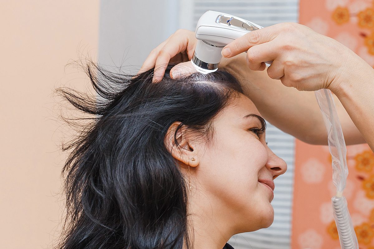 Femmes et perte de cheveux: les 10 meilleurs remèdes et ...